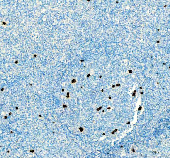 Anti-CTLA4 Antibody