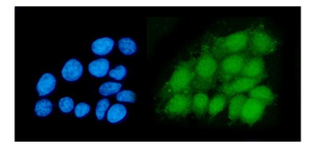 Anti-DHPS/DHS Antibody
