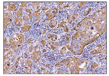 Anti-DHPS/DHS Antibody