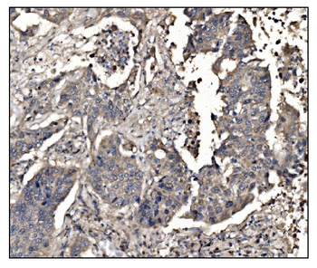 Anti-DHPS/DHS Antibody