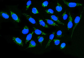 Anti-DLGAP1 Antibody