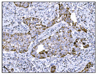 Anti-DLGAP1 Antibody