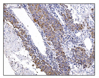 Anti-DLGAP1 Antibody