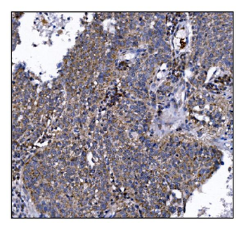 Anti-DLGAP1 Antibody