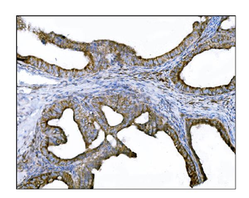 Anti-DLGAP1 Antibody