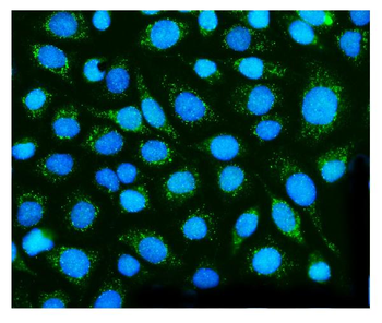 Anti-Dysferlin/DYSF Antibody