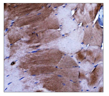 Anti-Dysferlin/DYSF Antibody