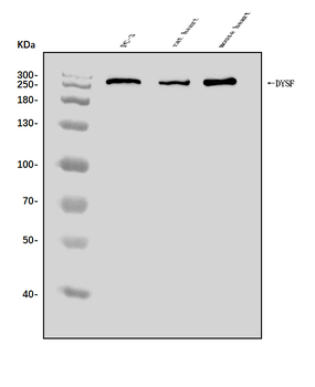 Anti-Dysferlin/DYSF Antibody