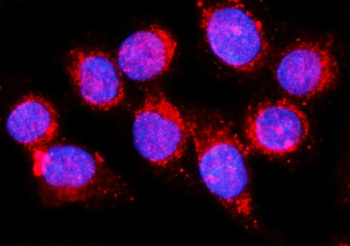 Anti-EHD1 Antibody