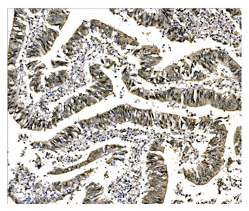 Anti-EHMT2/G9A Antibody