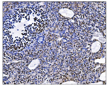 Anti-EHMT2/G9A Antibody