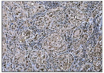 Anti-Fos B/FOSB Antibody