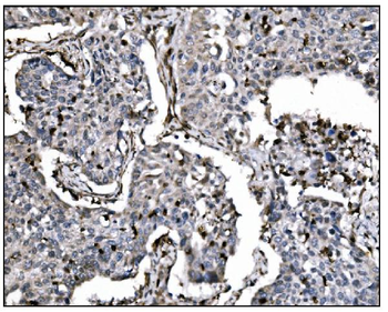 Anti-Fos B/FOSB Antibody
