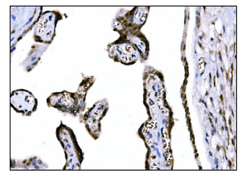 Anti-Fos B/FOSB Antibody