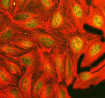Anti-FTO Antibody