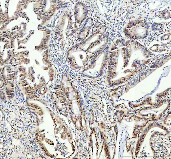 Anti-FTO Antibody