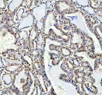 Anti-FTO Antibody