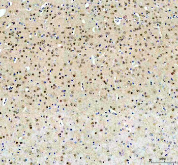 Anti-FTO Antibody