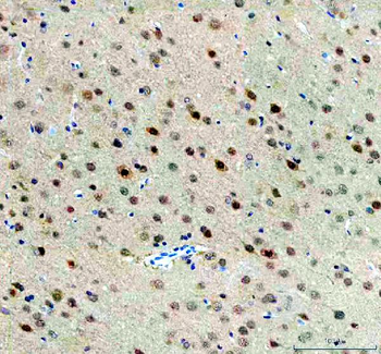 Anti-FTO Antibody