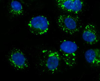 Anti-GOLPH2/GOLM1 Antibody