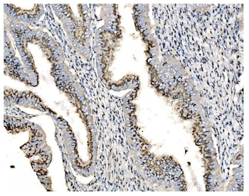 Anti-GOLPH2/GOLM1 Antibody