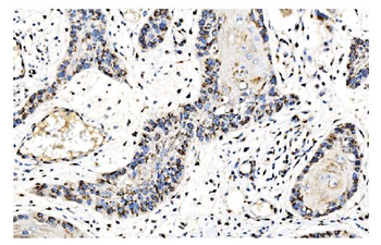 Anti-GOLPH2/GOLM1 Antibody