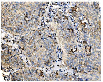 Anti-GOLPH2/GOLM1 Antibody