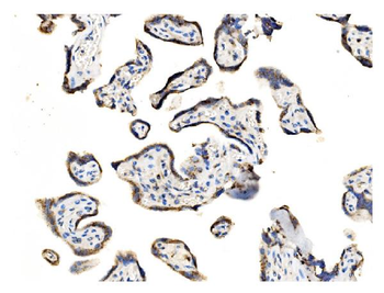 Anti-GOLPH2/GOLM1 Antibody