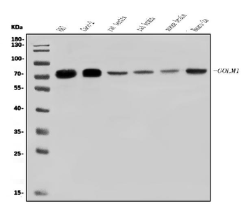 Anti-GOLPH2/GOLM1 Antibody