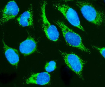 Anti-HCCS Antibody