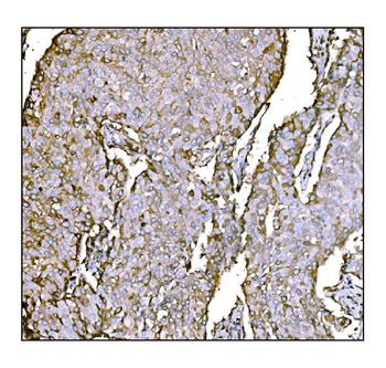 Anti-HCCS Antibody
