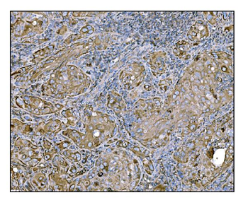 Anti-HCCS Antibody