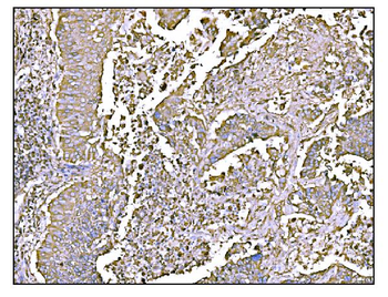 Anti-HCCS Antibody