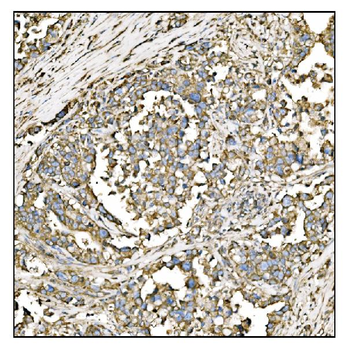 Anti-HCCS Antibody