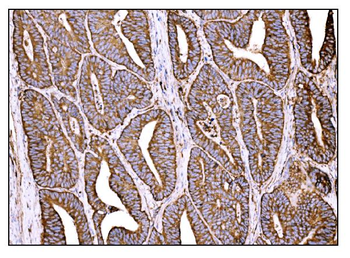 Anti-HCCS Antibody