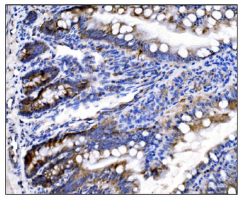 Anti-HCCS Antibody
