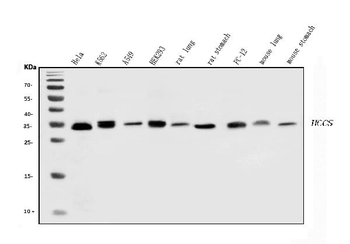 Anti-HCCS Antibody