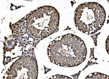 Anti-HDAC2 Antibody
