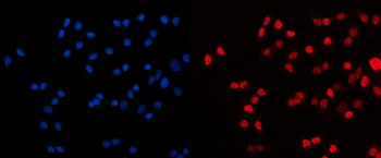 Anti-HDAC2 Antibody