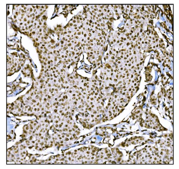 Anti-HDAC2 Antibody