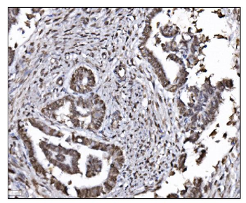 Anti-HDAC2 Antibody