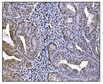 Anti-HDAC2 Antibody