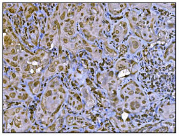 Anti-HDAC2 Antibody