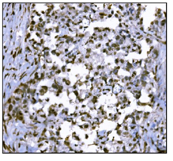 Anti-HDAC2 Antibody
