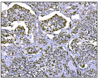 Anti-HDAC2 Antibody