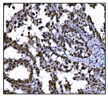 Anti-HDAC2 Antibody