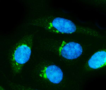 Anti-alpha Internexin/INA Antibody