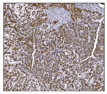 Anti-LRP1B Antibody