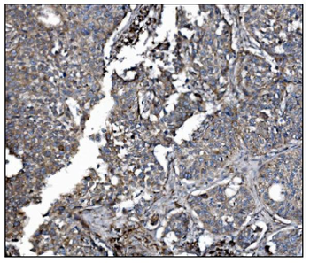 Anti-LRP1B Antibody