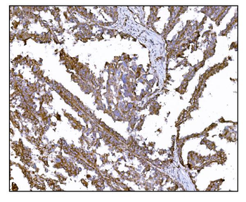 Anti-LRP1B Antibody